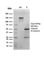 Interferon gamma (IFNG) Monoclonal Antibody (IFNG/464)
