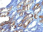 Interferon gamma (IFNG) Monoclonal Antibody (IFNG/466)