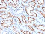 Interferon gamma (IFNG) Recombinant Rabbit Monoclonal Antibody (IFNG, 3996R)