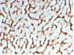 Apolipoprotein D/APO-D Monoclonal Antibody (APOD/3413)