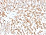 Apolipoprotein D/APO-D Monoclonal Antibody (APOD/3415)
