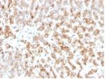 Apolipoprotein D/APO-D Monoclonal Antibody (APOD/3415)
