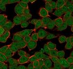 ZNF81/Zinc finger protein 81 (Transcription Factor) Monoclonal Antibody (PCRP-ZNF81-2G2)