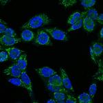 Insulin-like Growth Factor-1 (IGF-1) Monoclonal Antibody (IGF1, 1020)