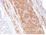 Apolipoprotein E/APOE Monoclonal Antibody (APOE/3671)