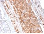 Apolipoprotein E/APOE Monoclonal Antibody (APOE/3671)