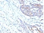IGF1R/CD221 Antibody in Immunohistochemistry (Paraffin) (IHC (P))