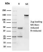 IGF1R alpha/CD221 Monoclonal Antibody (24-60)