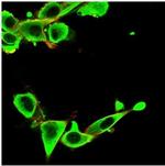 IGFBP3 Monoclonal Antibody (IGFBP3/3424)