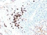 IgA (Immunoglobulin Alpha Heavy Chain) (B-Cell Marker) Recombinant Rabbit Monoclonal Antibody (IGHA/3877R)