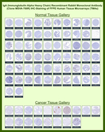 IgA (Immunoglobulin Alpha Heavy Chain) (B-Cell Marker) Recombinant Rabbit Monoclonal Antibody (MSVA-700R)