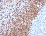 IgD (Immunoglobulin Delta Heavy Chain) (B-Cell Marker) Recombinant Rabbit Monoclonal Antibody (IGHD/2730R)