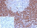 IgD (Immunoglobulin Delta Heavy Chain) (B-Cell Marker) Recombinant Rabbit Monoclonal Antibody (IGHD/6818R)