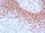 IgD (Immunoglobulin Delta Heavy Chain) (B-Cell Marker) Recombinant Rabbit Monoclonal Antibody (IGHD/8367R)