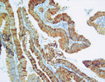 Thymidylate Synthase Antibody in Immunohistochemistry (IHC)