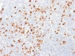 IgG (Immunoglobulin Gamma Heavy Chain) Recombinant Mouse Monoclonal Antibody (rIG266)