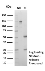 IgG (Immunoglobulin Gamma Heavy Chain) (B-Cell Marker) Recombinant Mouse Monoclonal Antibody (rIGHG1/13035)