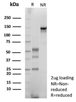 IgG (Immunoglobulin Gamma Heavy Chain) (B-Cell Marker) Antibody in SDS-PAGE (SDS-PAGE)