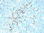 Immunoglobulin Gamma (IgG) Heavy Chain Monoclonal Antibody (IG217, IG266)