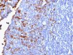 IgG (Immunoglobulin Gamma Heavy Chain) (B-Cell Marker) Recombinant Rabbit Monoclonal Antibody (IG1707R)