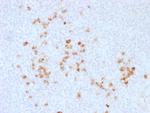 IgG (Immunoglobulin Gamma Heavy Chain) (B-Cell Marker) Polyclonal Antibody