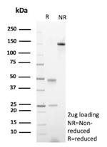 beta Amyloid Antibody in SDS-PAGE (SDS-PAGE)