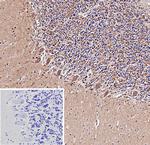 beta Amyloid Antibody in Immunohistochemistry (Paraffin) (IHC (P))