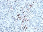Kappa Light Chain (B-Cell Marker) Monoclonal Antibody (KLC264)