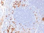 Kappa Light Chain/IGKC Monoclonal Antibody (KLC709)