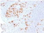 Kappa Light Chain/IGKC Recombinant Rabbit Monoclonal Antibody (KLC2289R)