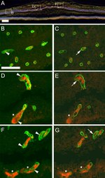 Claudin 5 Antibody in Immunohistochemistry (IHC)
