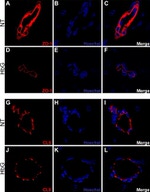 Claudin 5 Antibody in Immunohistochemistry (IHC)