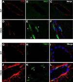 Claudin 5 Antibody in Immunohistochemistry (IHC)