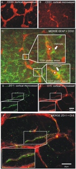 Claudin 5 Antibody in Immunohistochemistry (IHC)