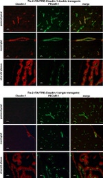 Claudin 1 Antibody in Immunohistochemistry (IHC)