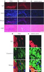 Claudin 5 Antibody in Immunohistochemistry (IHC)