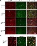 Claudin 5 Antibody in Immunohistochemistry (IHC)