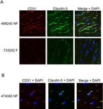 Claudin 5 Antibody in Immunohistochemistry (IHC)