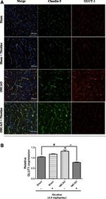 Claudin 5 Antibody in Immunohistochemistry (IHC)