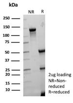 Lambda Light Chain (B-Cell Marker) Antibody in SDS-PAGE (SDS-PAGE)