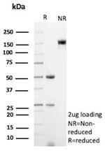 Lambda Light Chain (B-Cell Marker) Antibody in SDS-PAGE (SDS-PAGE)