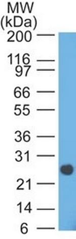 Lambda Light Chain (B-Cell Marker) Antibody in Western Blot (WB)