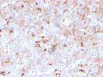 Lambda Light Chain Recombinant Mouse Monoclonal Antibody (rLLC, 1738)