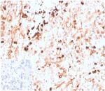 Lambda Light Chain (B-Cell Marker) Recombinant Rabbit Monoclonal Antibody (LLC/3774R)