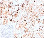 Lambda Light Chain (B-Cell Marker) Recombinant Rabbit Monoclonal Antibody (LLC/3774R)