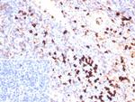 Lambda Light Chain (B-Cell Marker) Recombinant Rabbit Monoclonal Antibody (IGL/9397R)