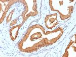 Prostate Specific Antigen (PSA) Antibody in Immunohistochemistry (Paraffin) (IHC (P))