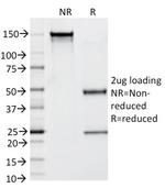 Prostate Specific Antigen (PSA) Antibody in SDS-PAGE (SDS-PAGE)
