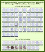 Prostate Specific Antigen (PSA) Recombinant Rabbit Monoclonal Antibody (MSVA-603R)