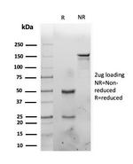 Interleukin-1 alpha (IL-1 alpha) Antibody in SDS-PAGE (SDS-PAGE)
